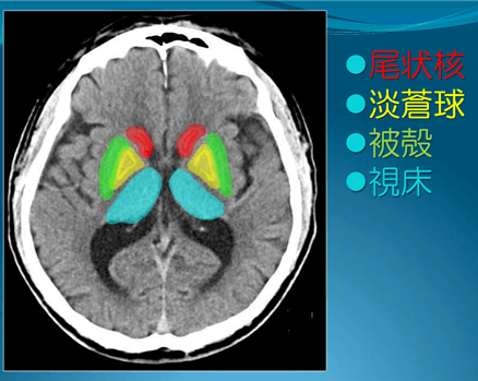 視床
