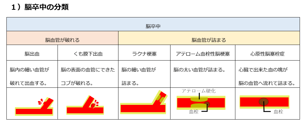 引用 脳卒中の治療と仕事のお役立ちノート
