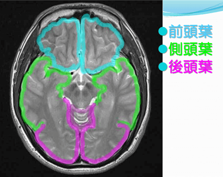 皮質下